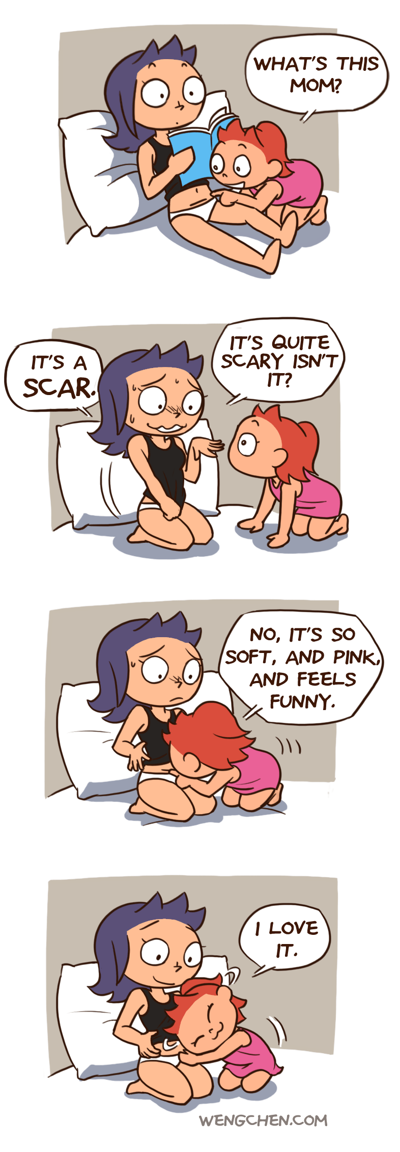 scar